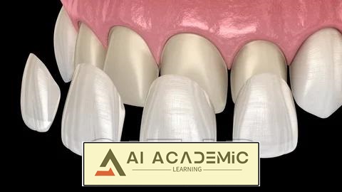 آموزش ونیرهای دندان - راهنمای کامل برای لبخندی عالی