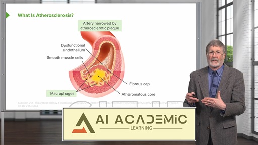 تصلب شرایین