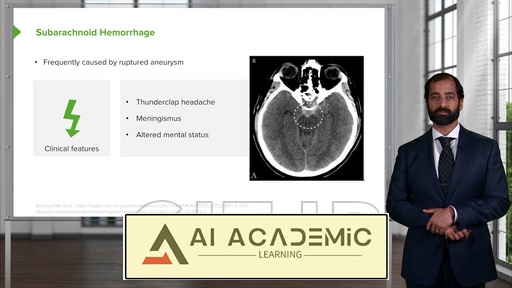 آنوریسم مغزی (آنوریسم داخل جمجمه‌ای)