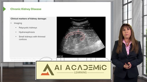 بیماری کلیوی مزمن (CKD)