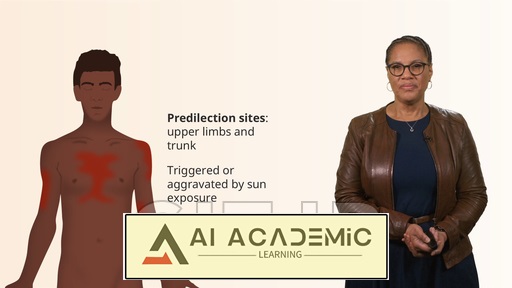 بیماری بافت همبند در بیماران با پوست تیره‌تر