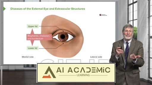 بیماری‌های چشم خارجی