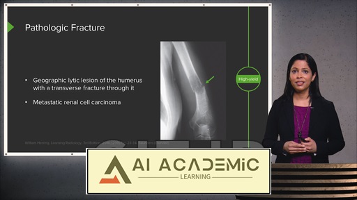 رادیولوژی اسکلتی-عضلانی
