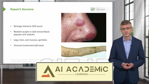 نئوپلاسم‌های پوست