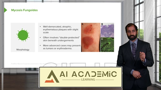 بیماری‌های نئوپلاستیک پوست