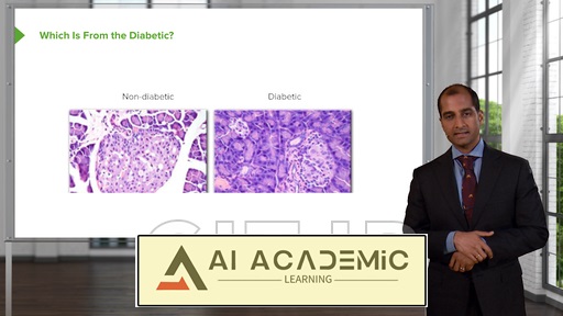 بیماری پانکراس و دیابت