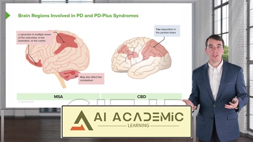 سندرم‌های پارکینسون پلاس