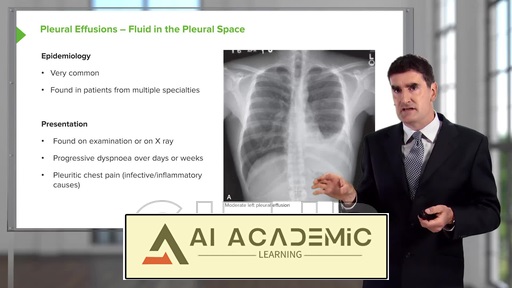 بیماری پلورال