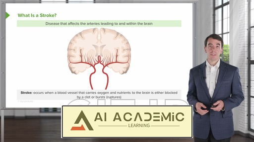 سکته مغزی و خونریزی داخل جمجمه‌ای