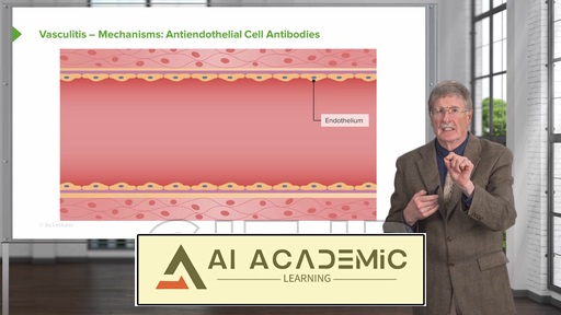 بیماری واسکولیت